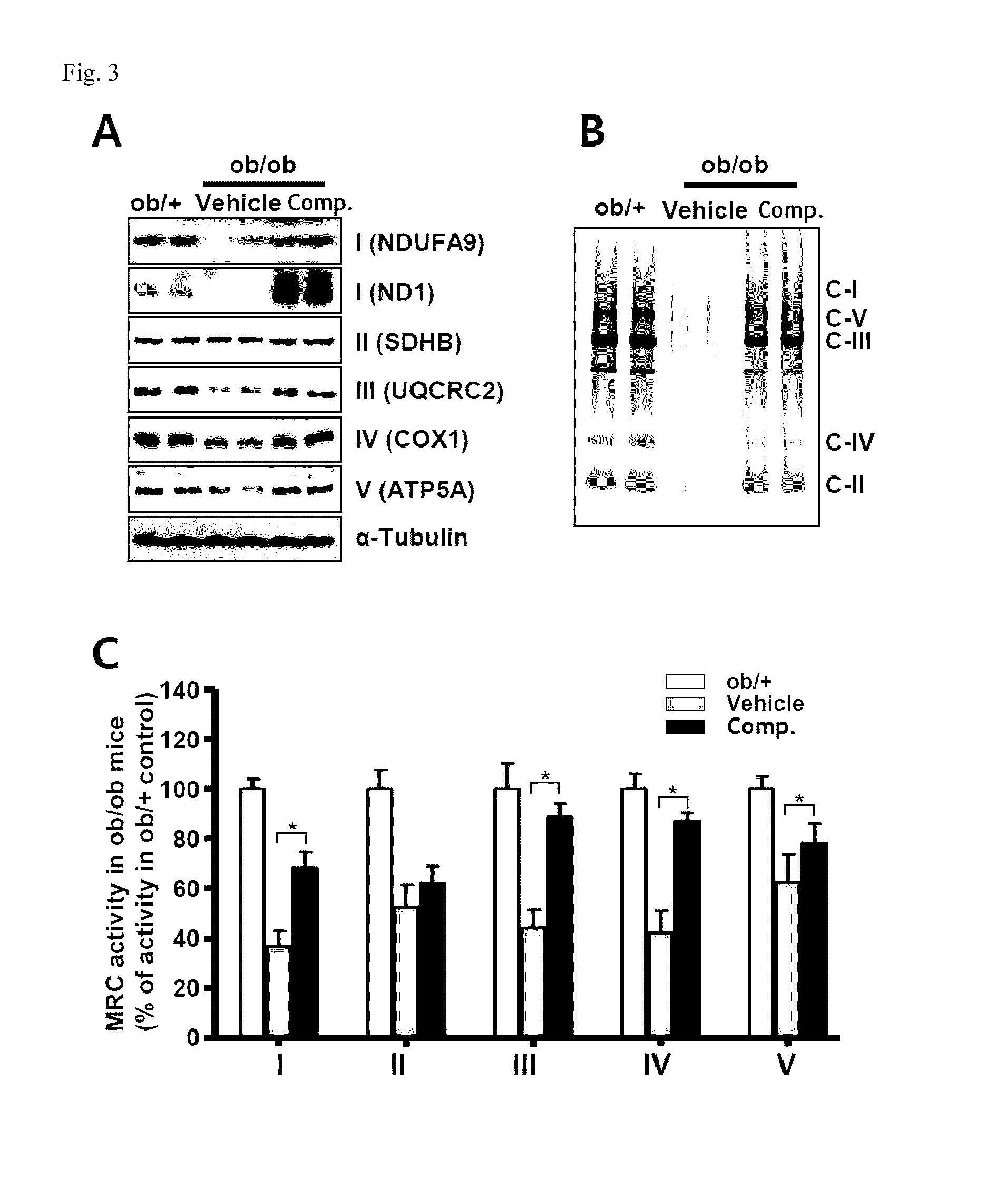 Composition for preventing or treating fatty liver diseases