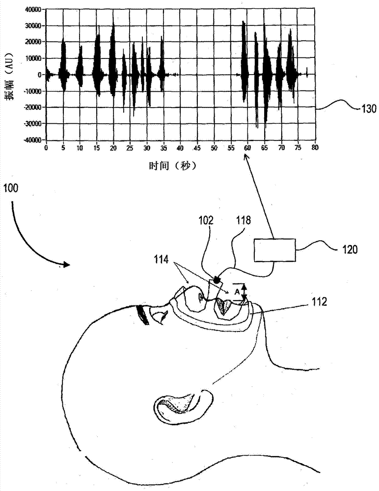 Osa/csa diagnosis using recorded breath sound amplitude profile and pitch contour