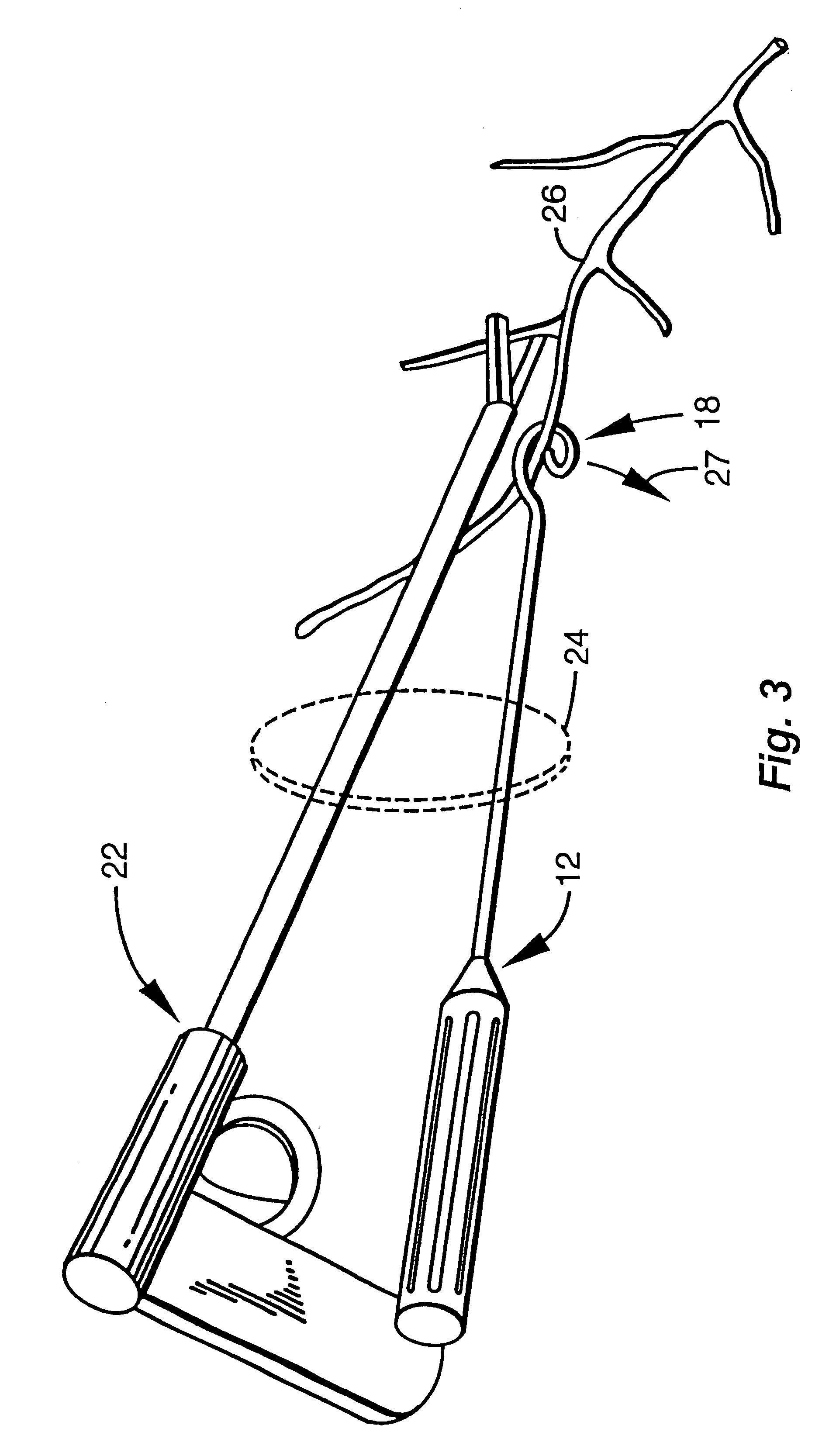 Surgical instrument for facilitating the detachment of an artery and the like