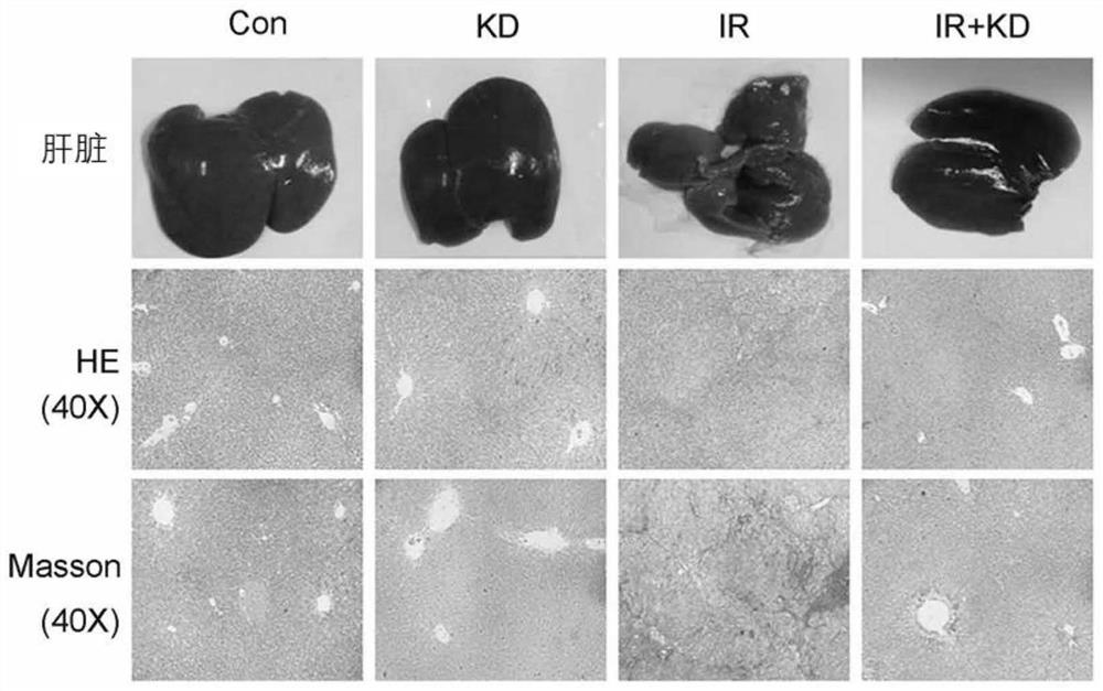 Application of kinsenoside in preparation of medicine for treating radiation hepatic fibrosis