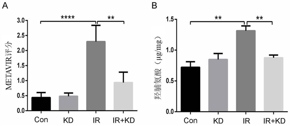 Application of kinsenoside in preparation of medicine for treating radiation hepatic fibrosis