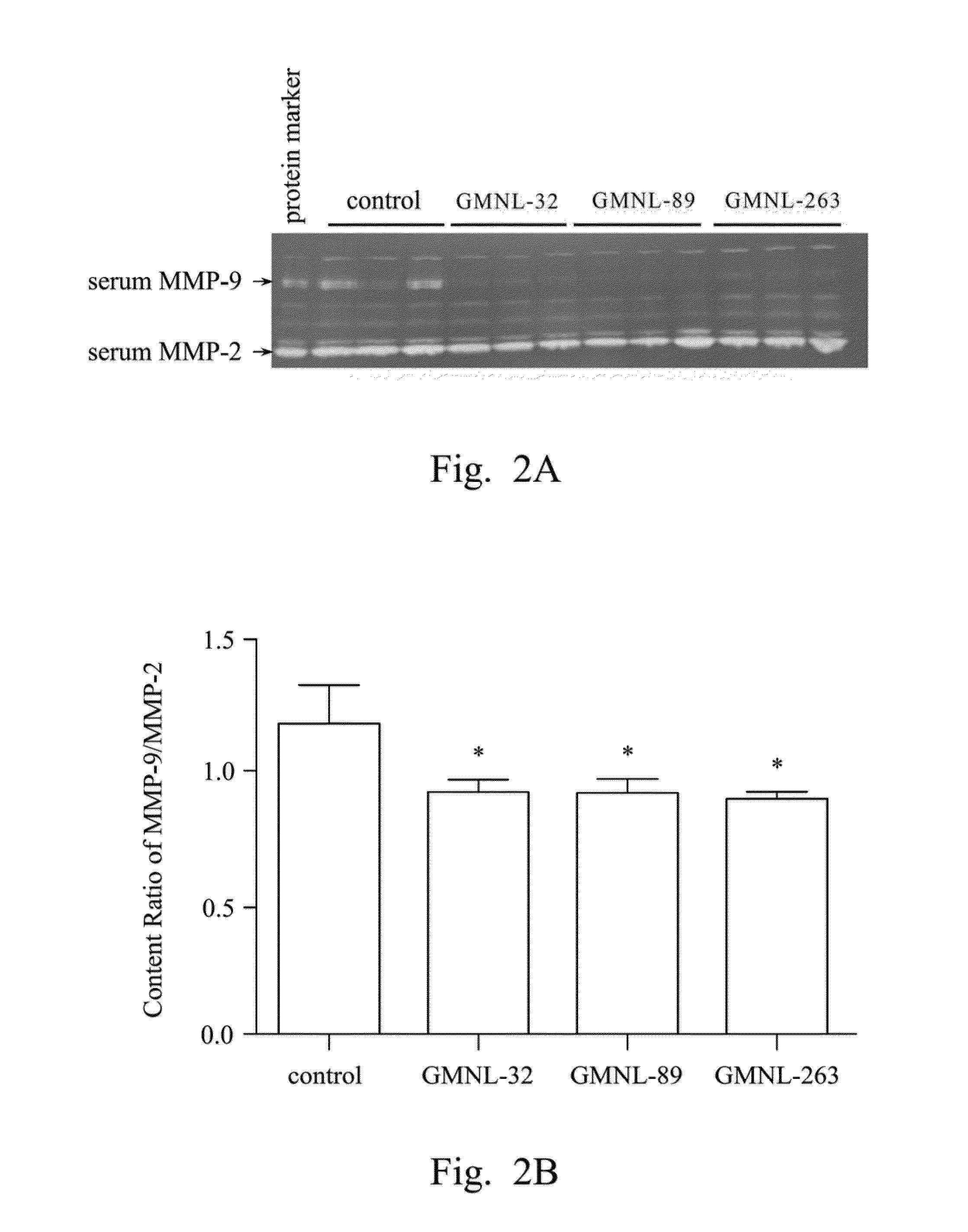 Lactobacillus strain, composition and use thereof for treating syndromes and related complications of autoimmune diseases