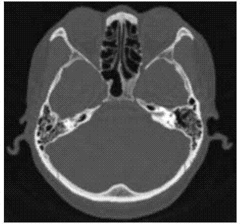 Three-dimensional human face change simulation method