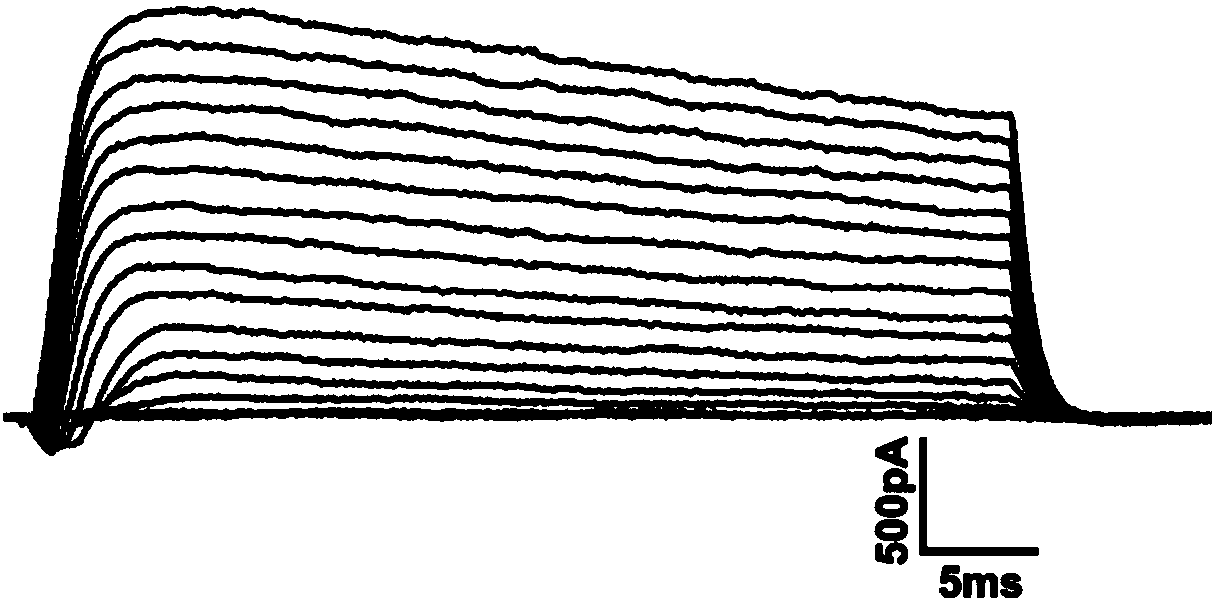 Application of adrenergic receptor antagonist in preparation of drug for relieving sodium current increasing caused by brain injury