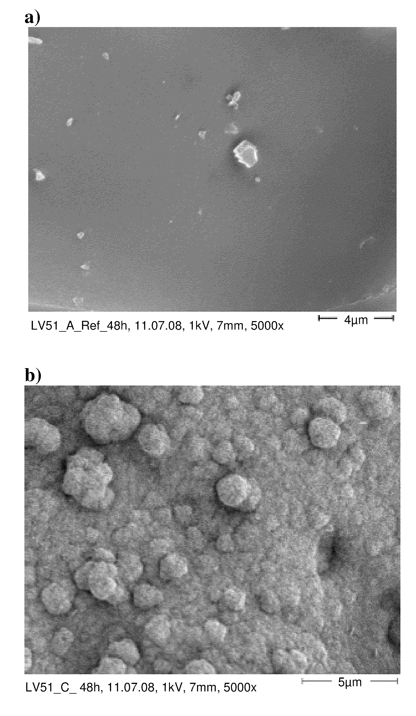 Bioactive bone cement and method for its production