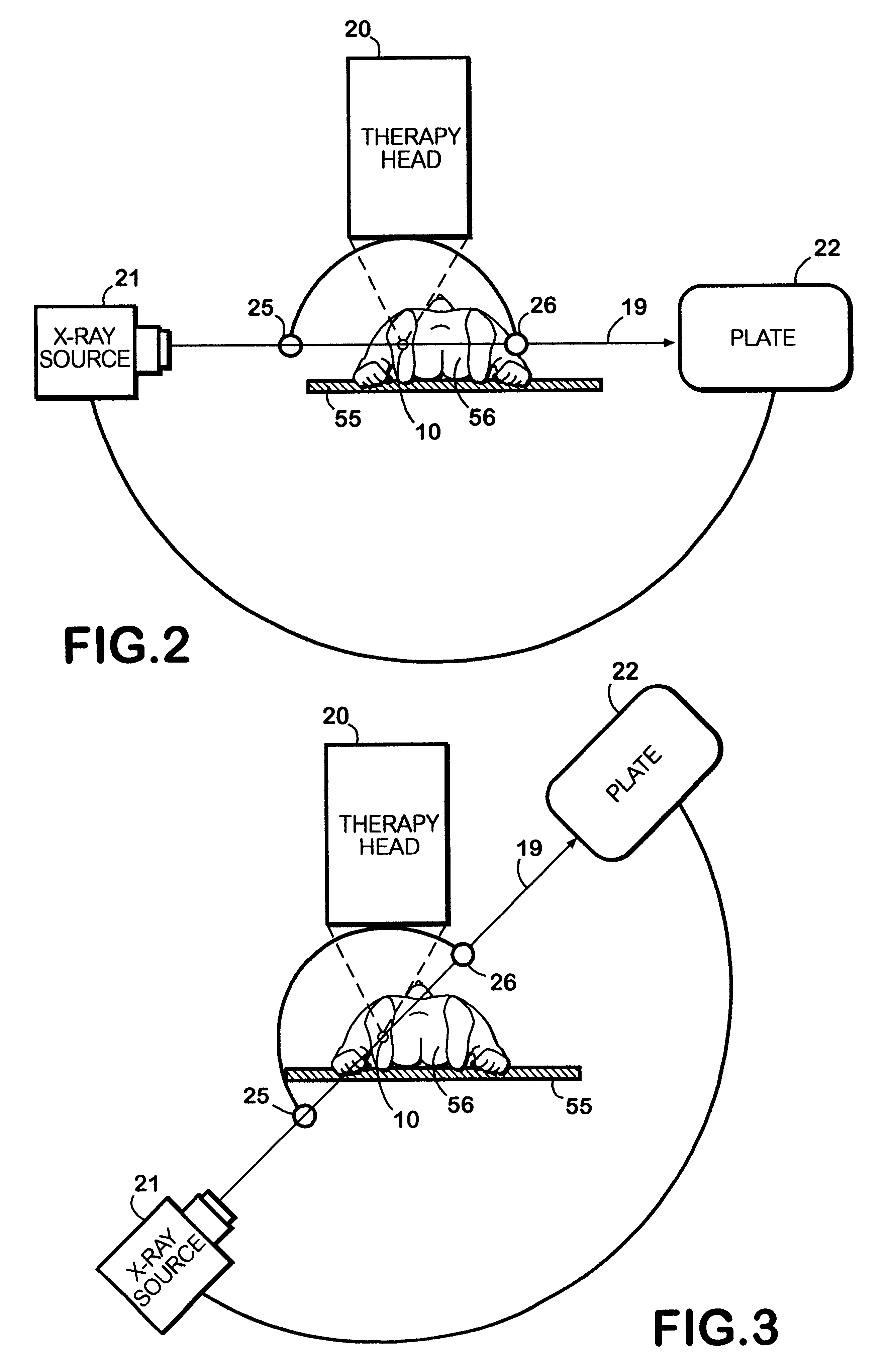 Method for using acoustic shock waves in the treatment of medical conditions