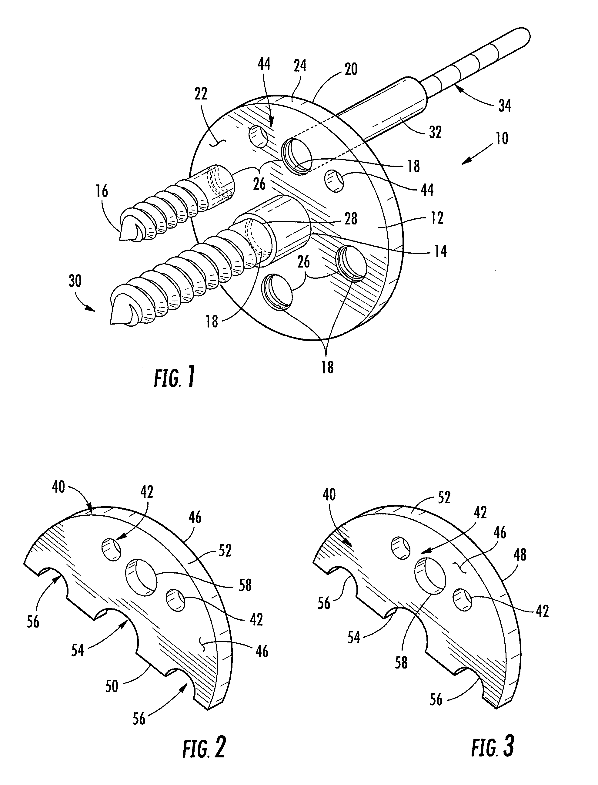 Base plate system for shoulder arthroplasty and method of using the same