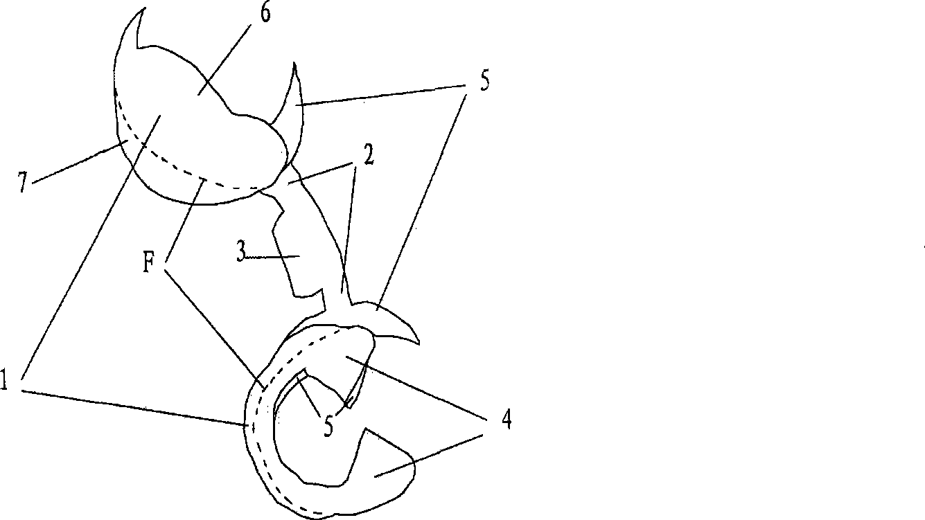 Split tooth prosthesis for fixing and repairing deficient toot and production method thereof