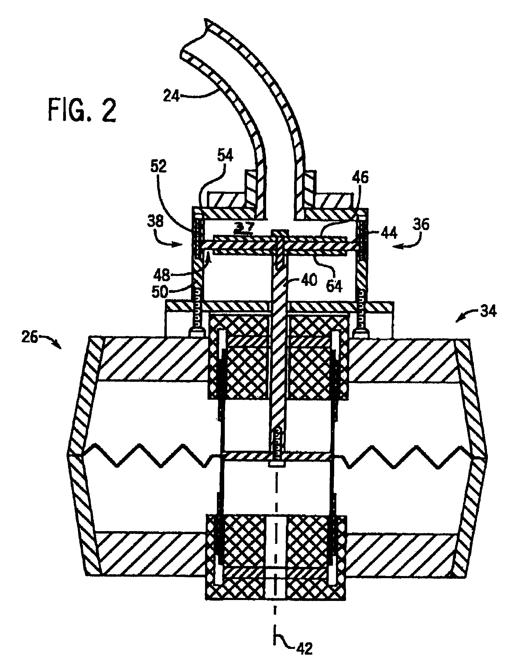 Flexible passive acoustic driver for magnetic resonance elastography