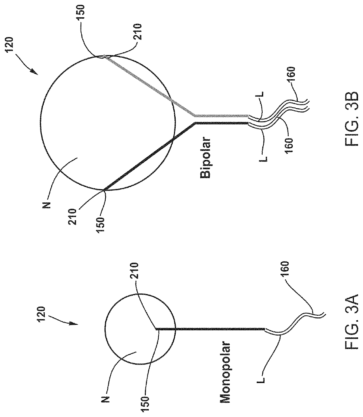 Device and method to selectively and reversibly modulate a nervous system structure to inhibit the perception of pain