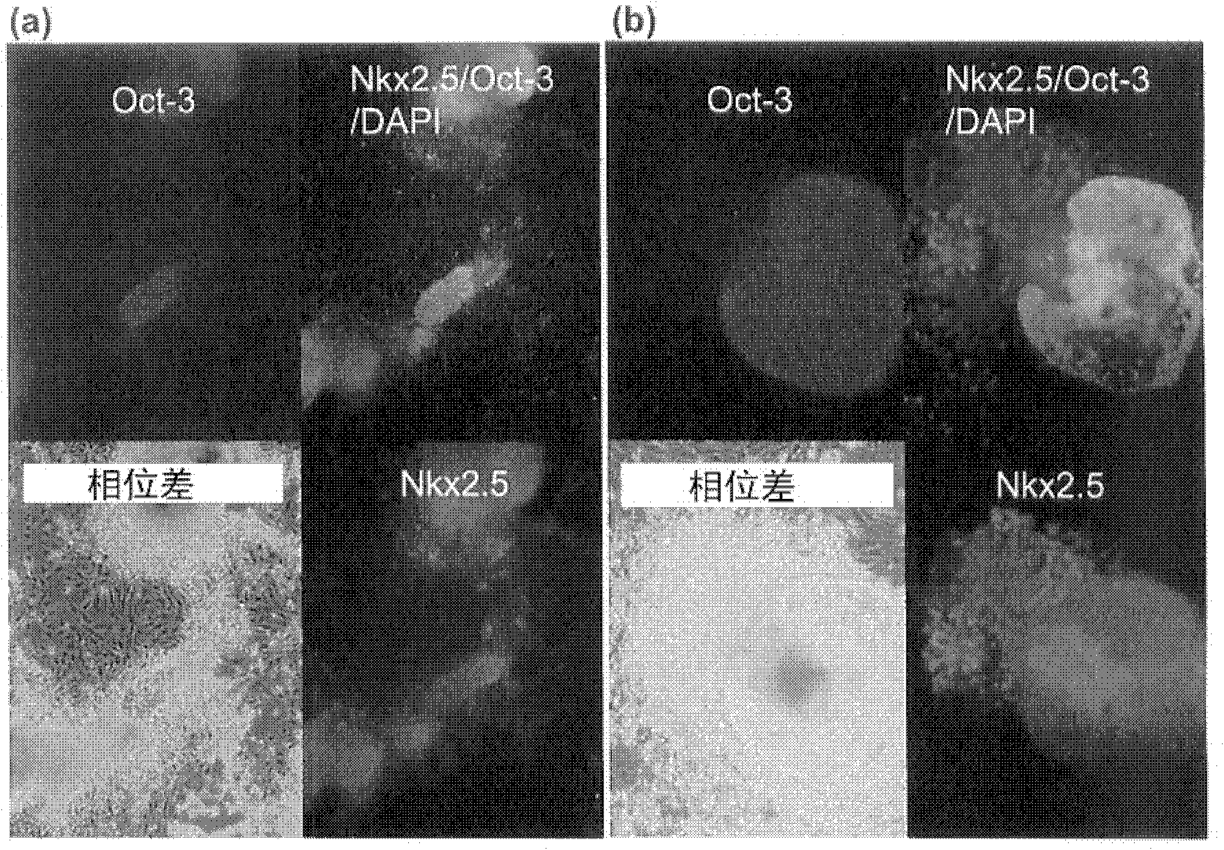 Method for inducing cell death in pluripotent stem cells and differentiated cells other than cardiac myocytes