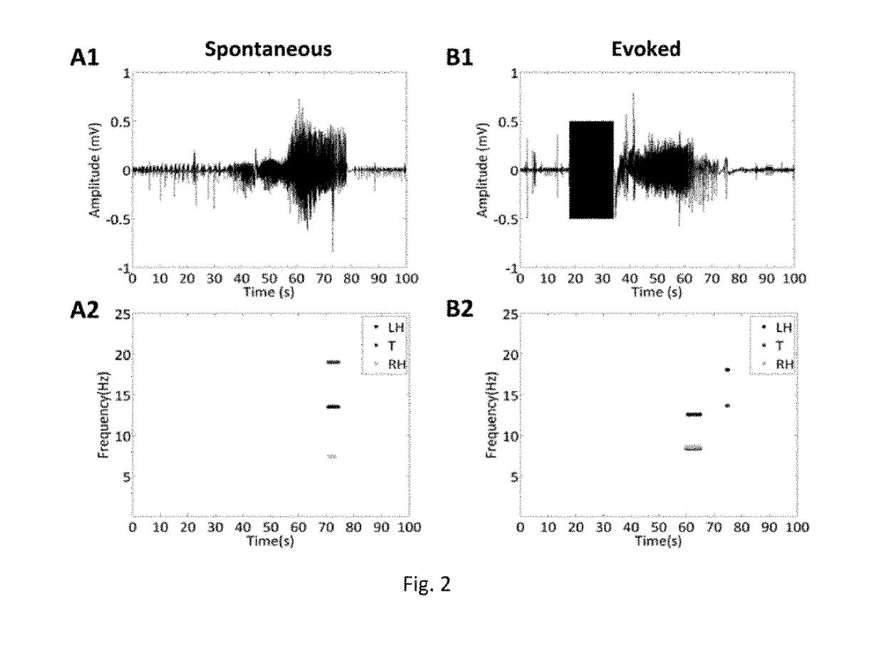 Method and apparatus for preventing or terminating epileptic seizures