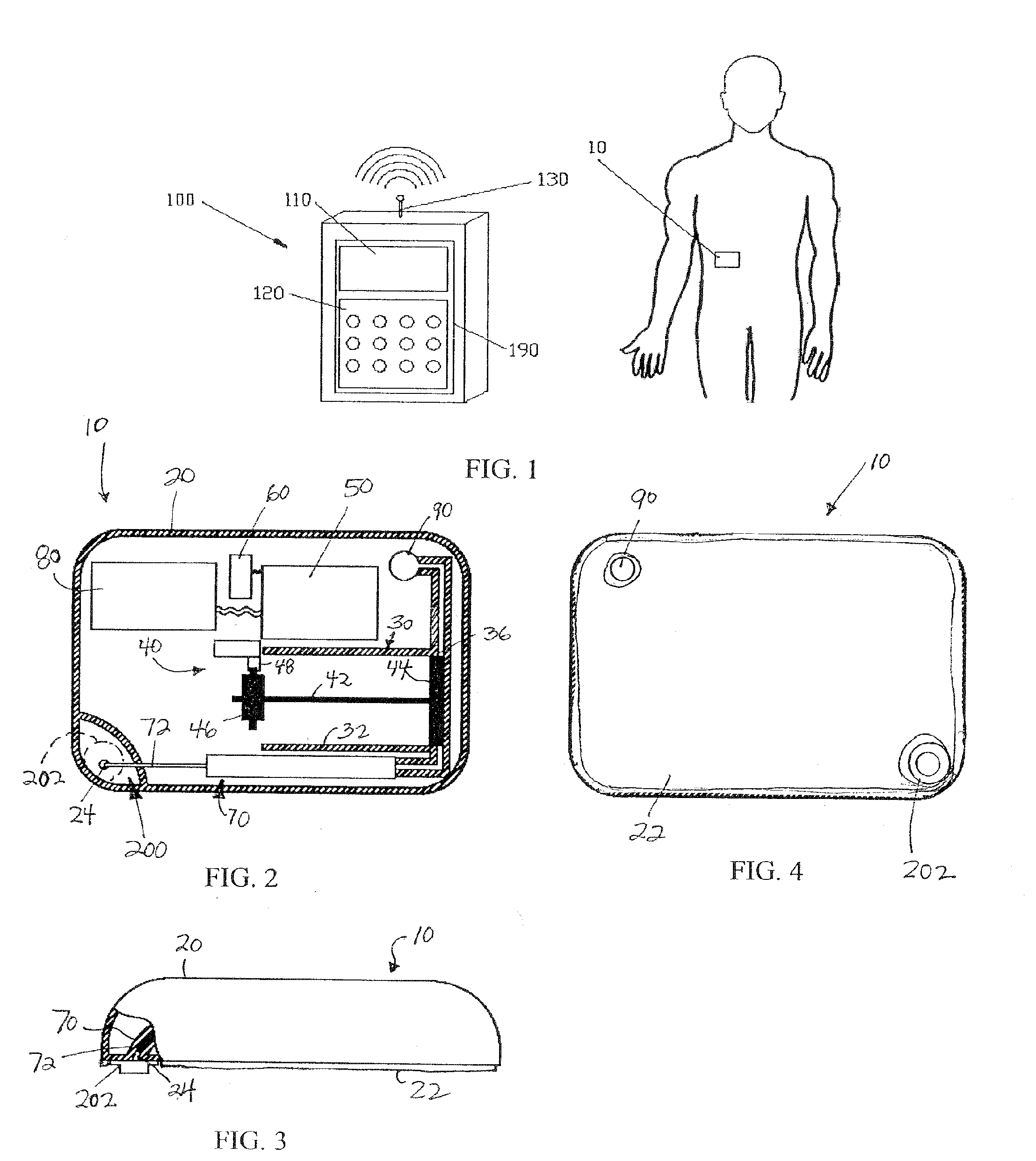 Flow restriction system and method for patient infusion device