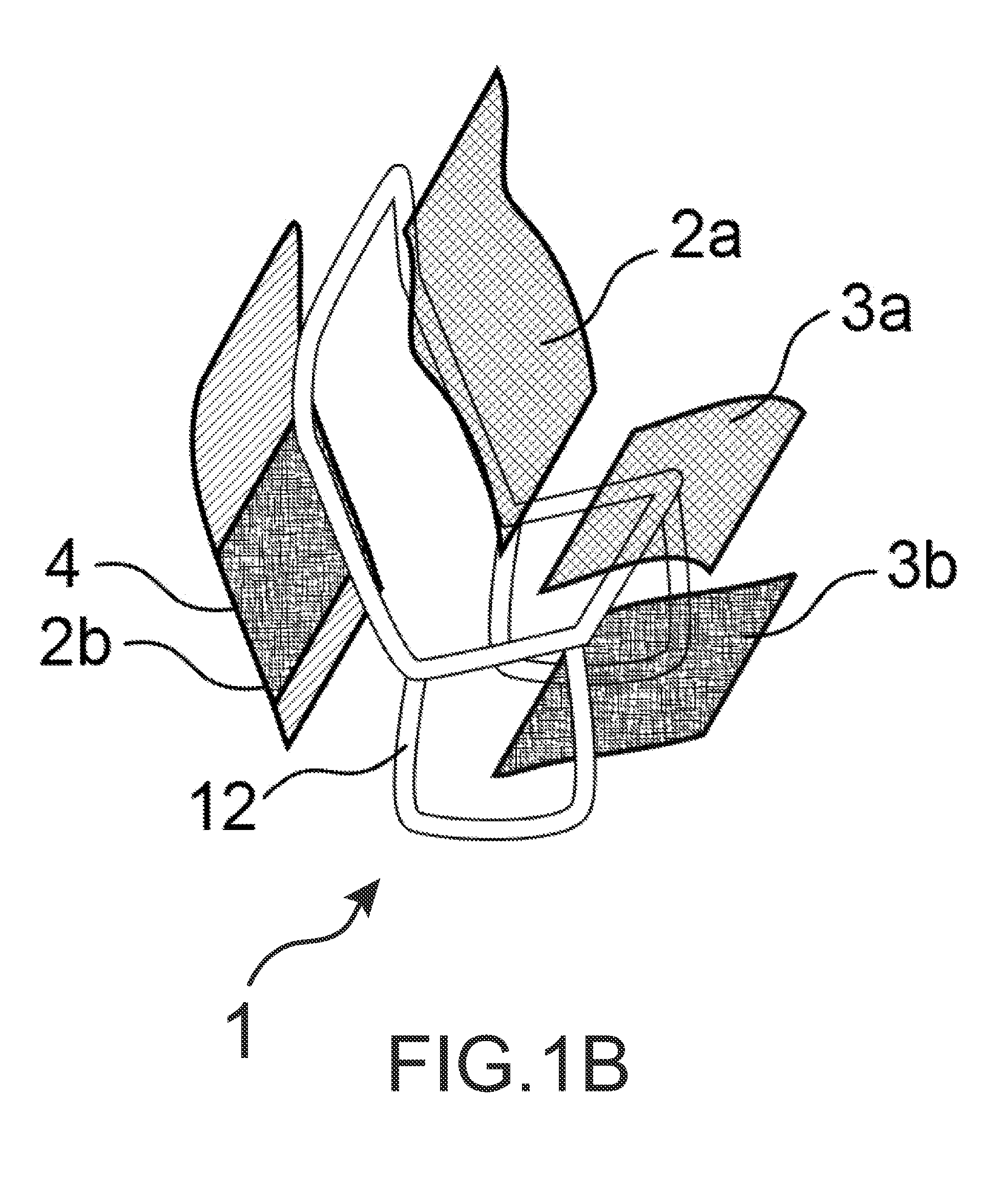 Vehicle seat comprising  an area that is deformable  in the event of an impact