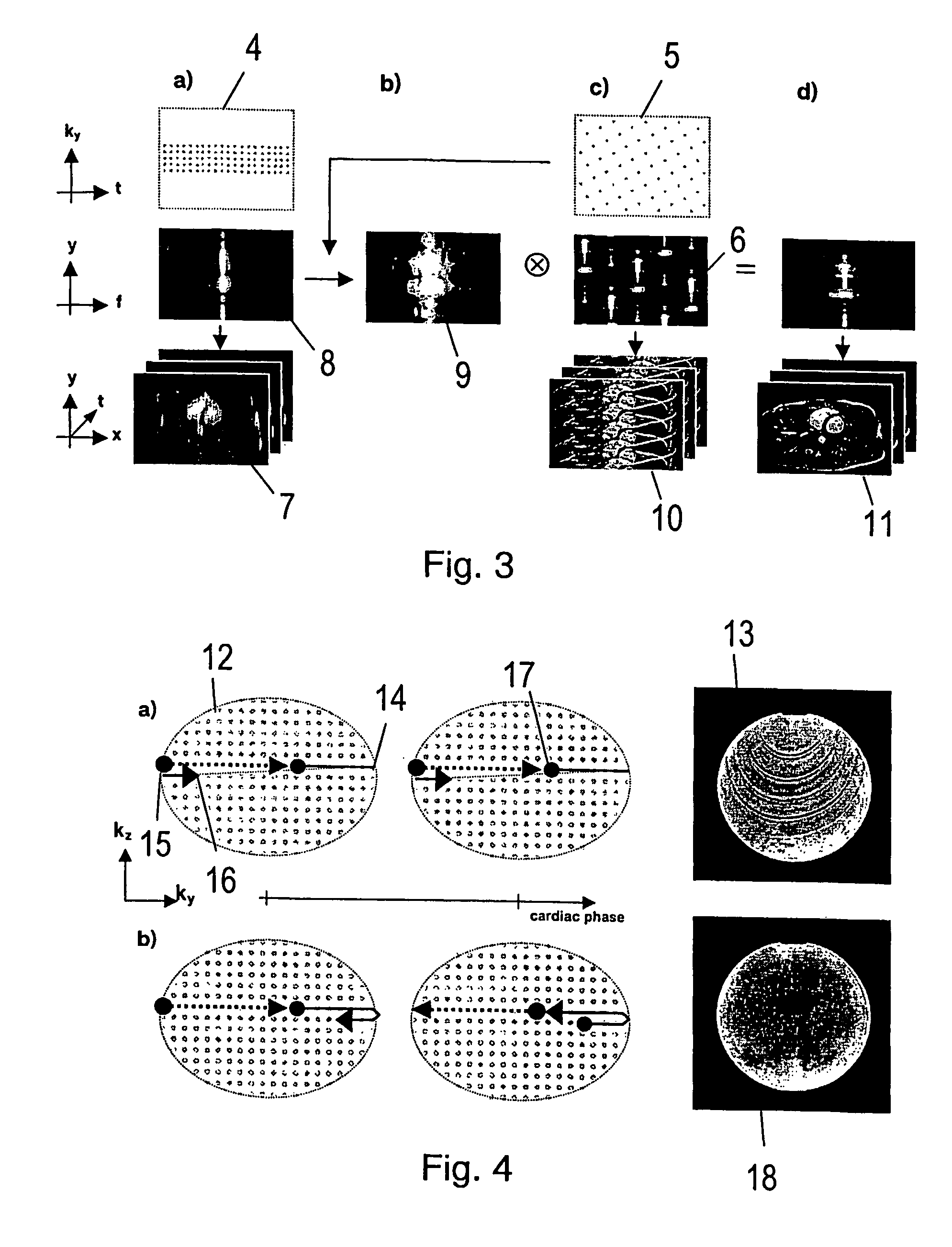 System and method of magnetic resonance imaging for producing successive magnetic resonance images