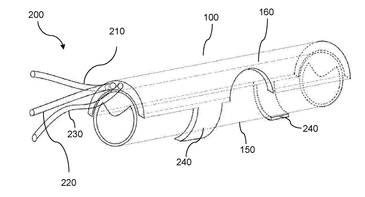 A system and method for treating artery