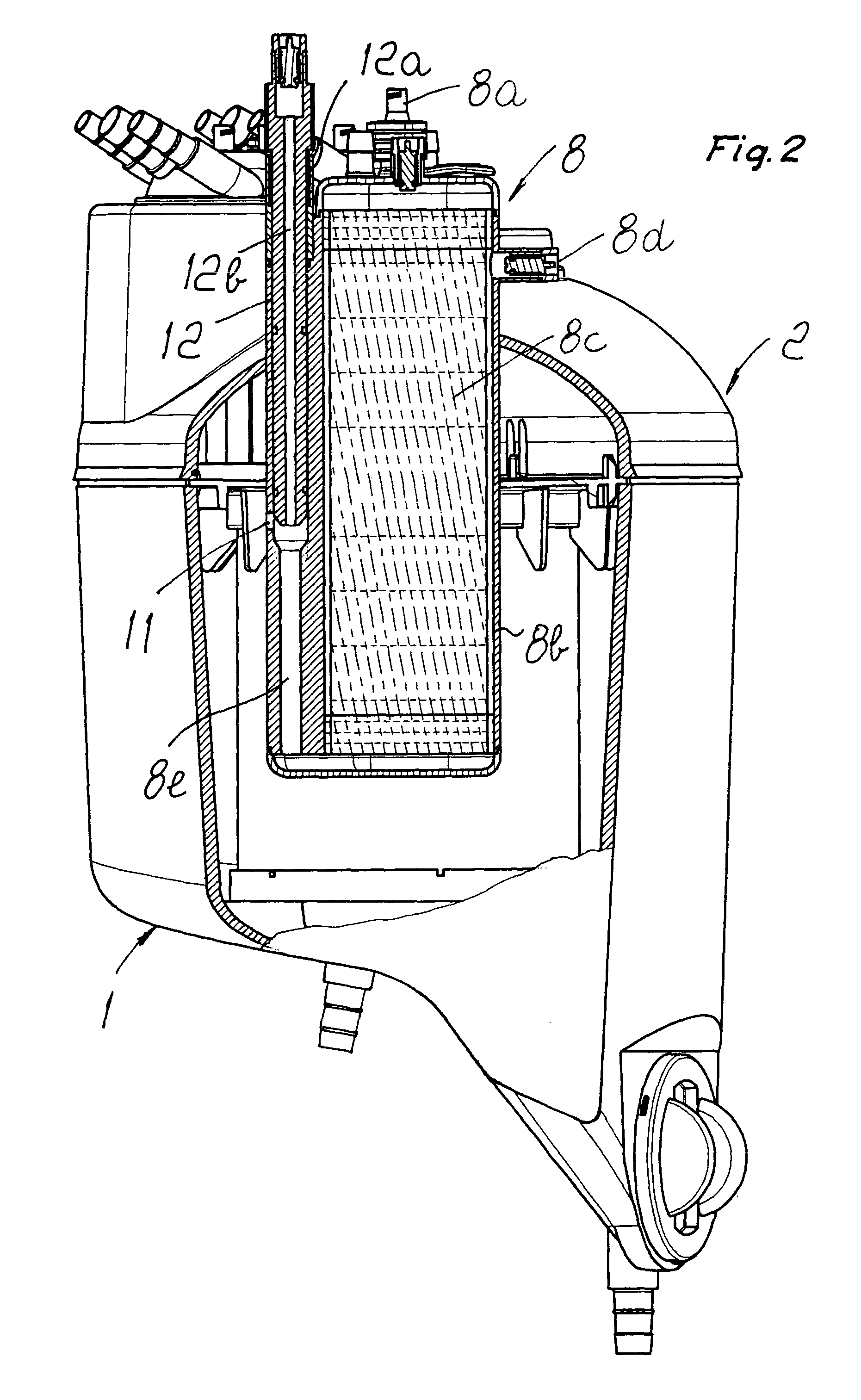 Hemoconcentrator in extracorporeal blood circuit