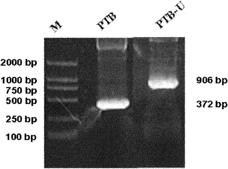 Recombinant ubiquitin ligase PTB-U-box fusion gene and expression vector and application thereof