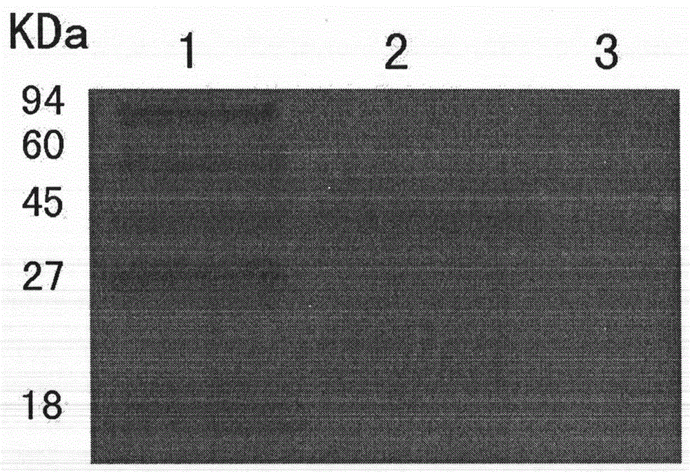 Indirect blocking ELISA (Enzyme-Linked Immuno Sorbent Assay) detection kit of antibody of porcine torque teno virus type II