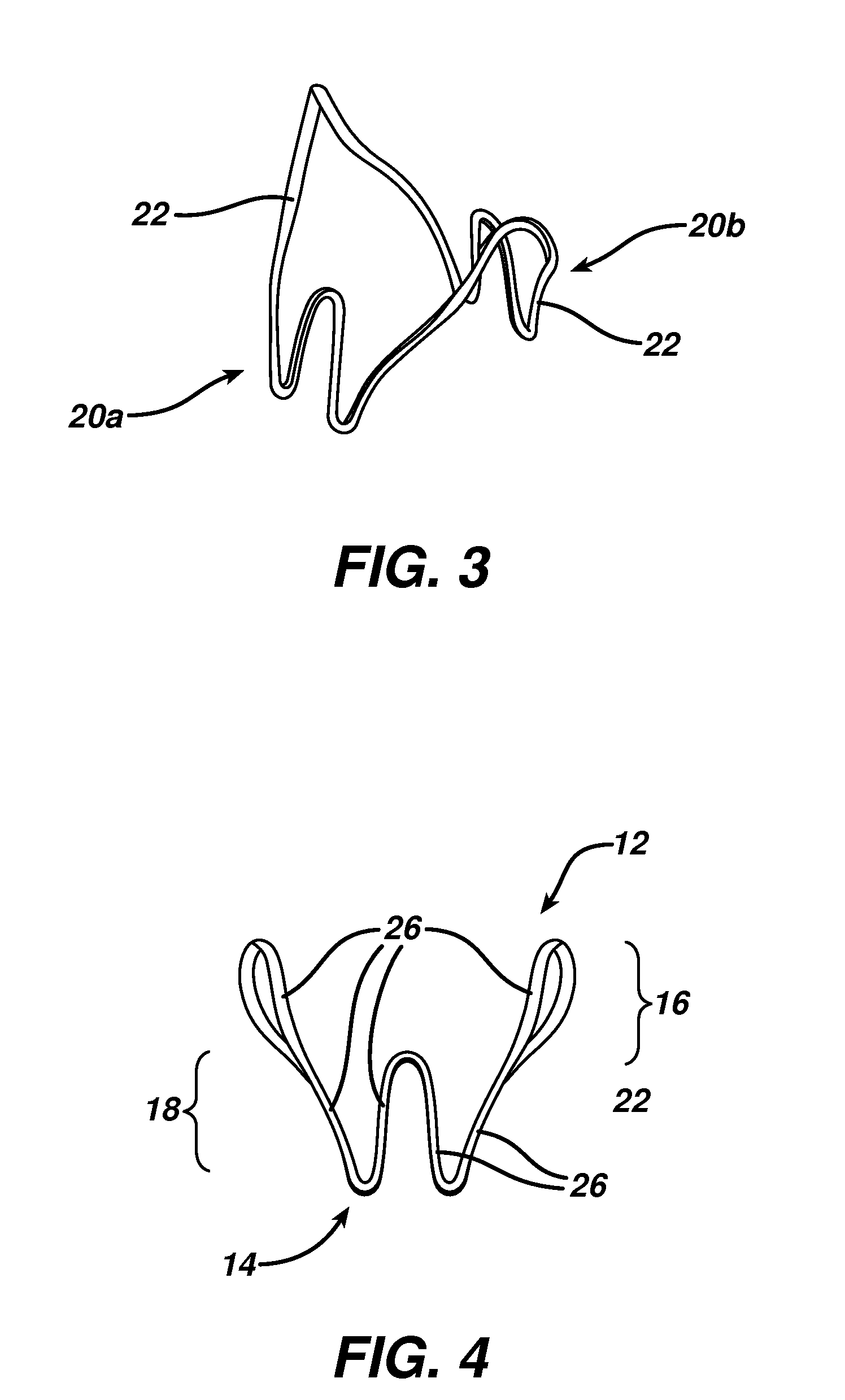 Cushioned Resilient Intravaginal Urinary Incontinence Device