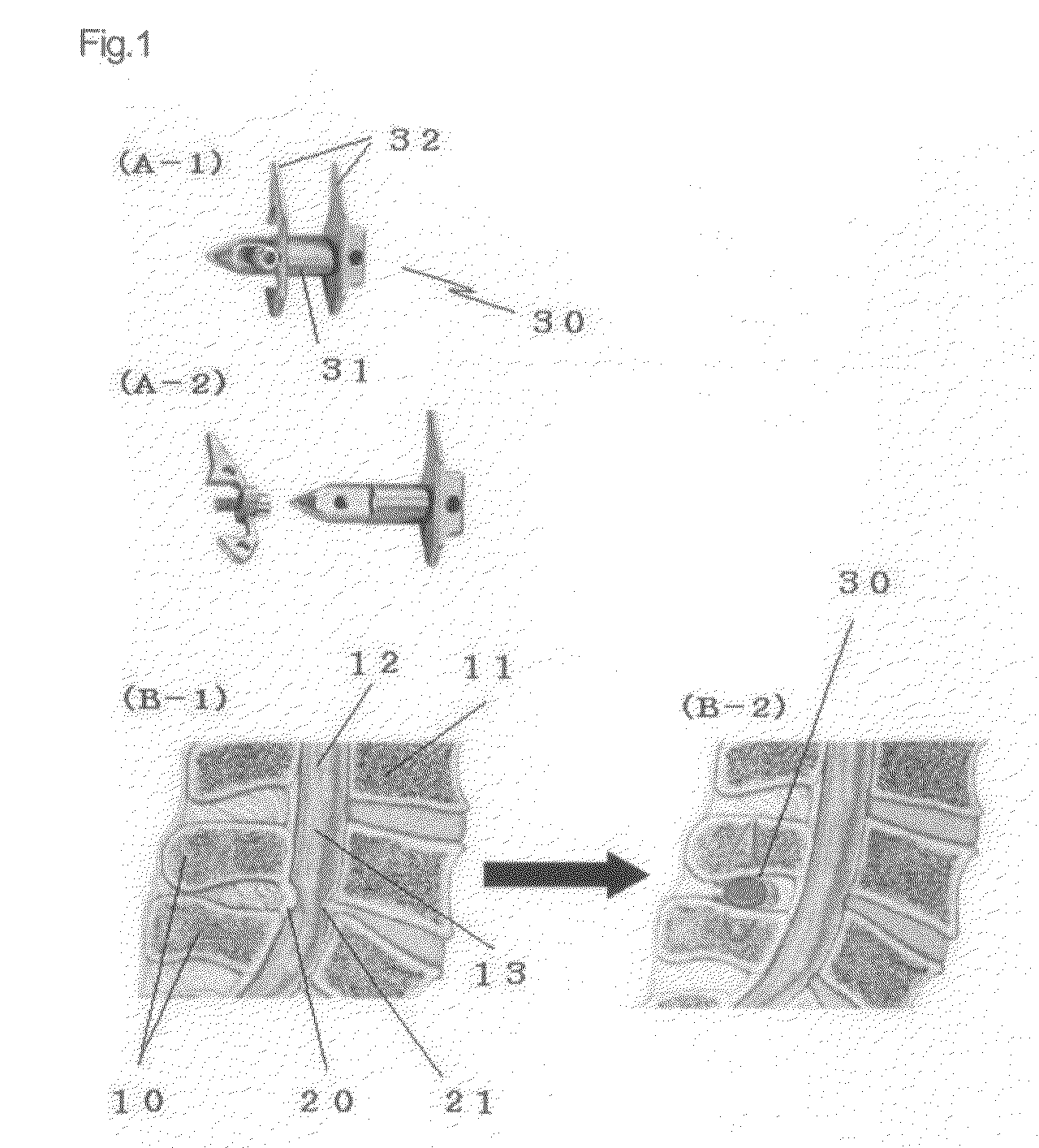 Minimally-Invasive Implant for Opening and Enlargement of Processus Spinosus Interspace and Method of Percutaneously Enlarging Processus Spinosus Interspace Therewith