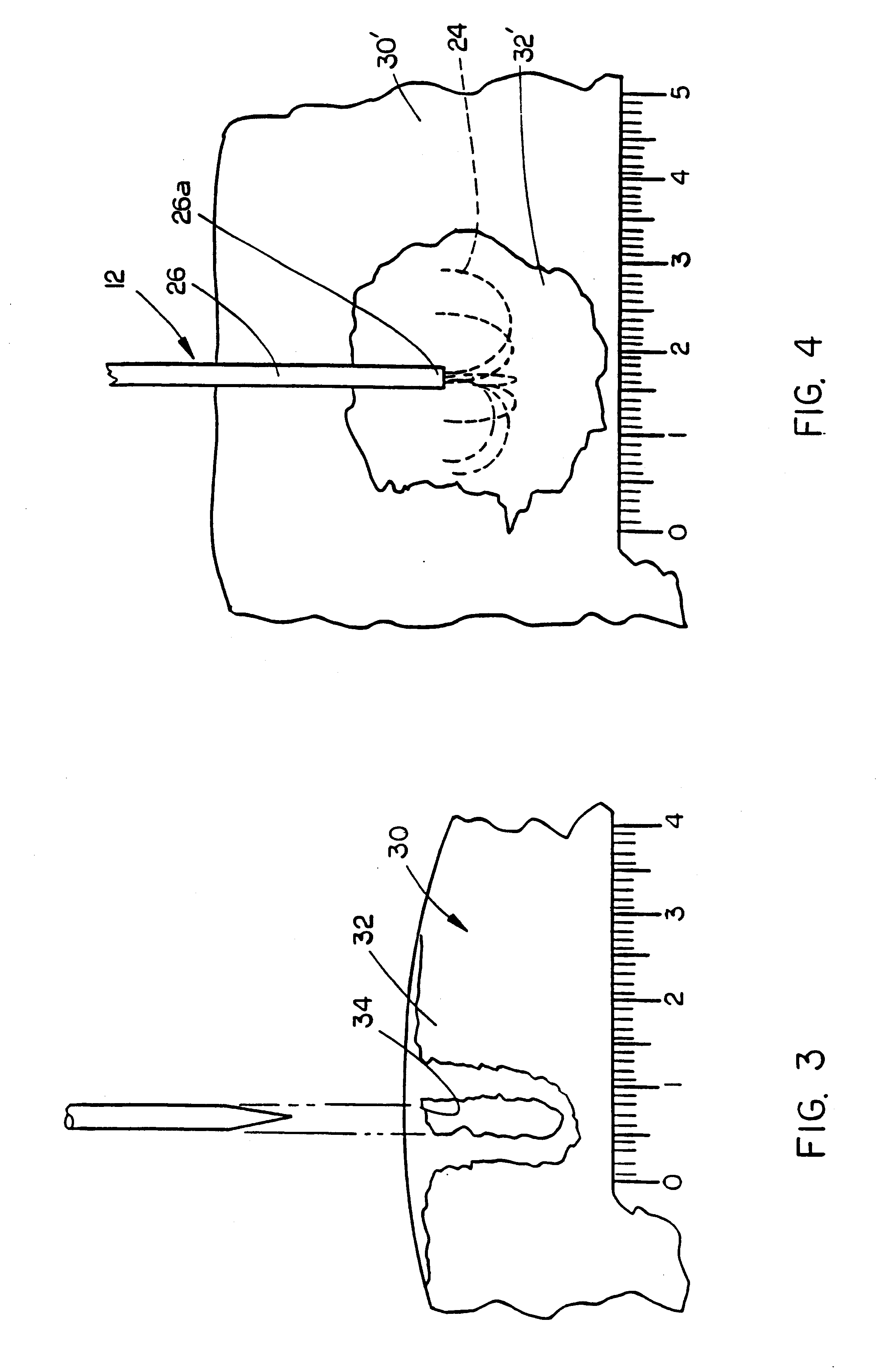 Method and systems for volumetric tissue ablation