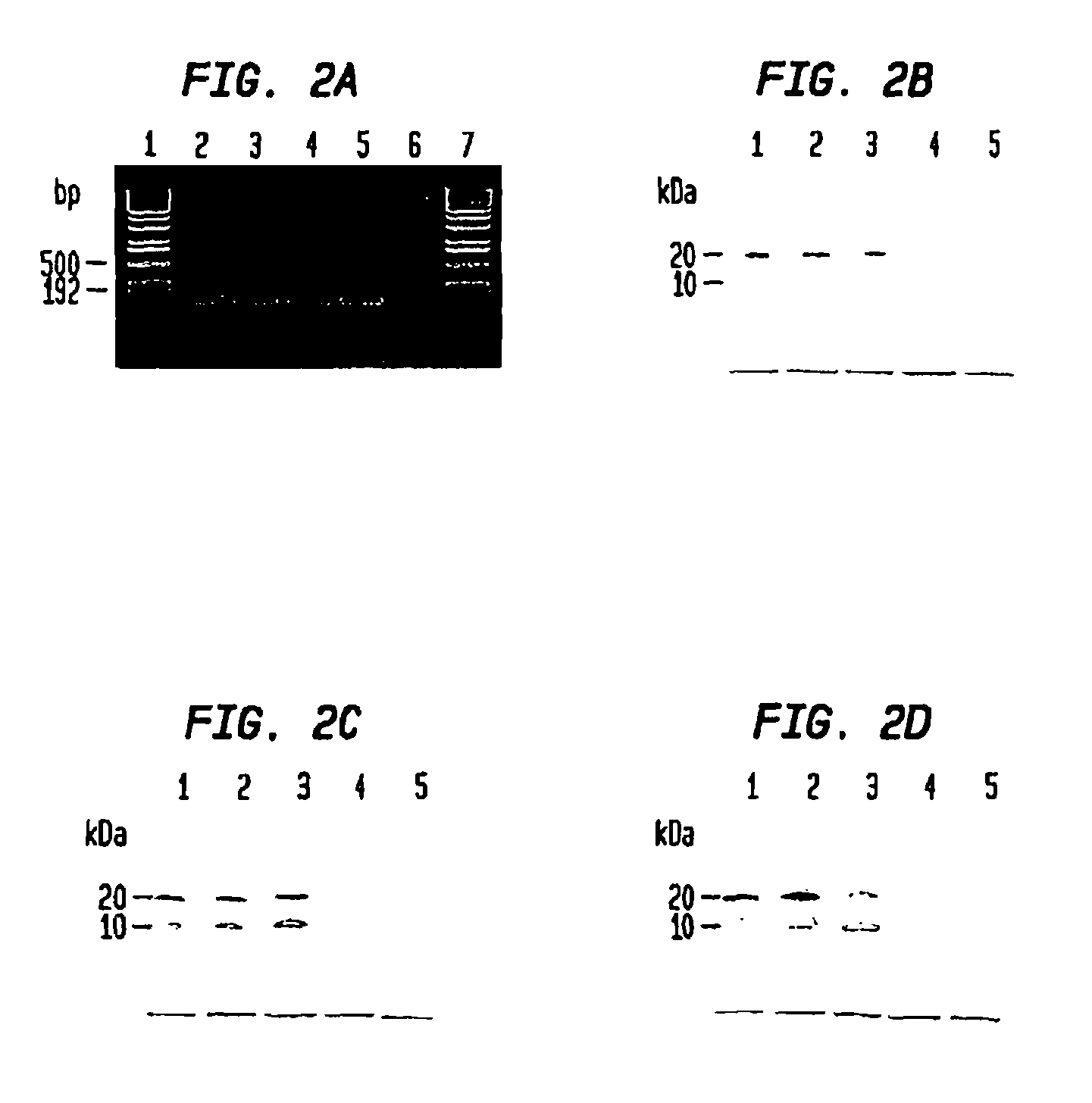 Diagnostic method for diseases by screening for hepcidin in human or animal tissues, blood or body fluids and therapeutic uses therefor