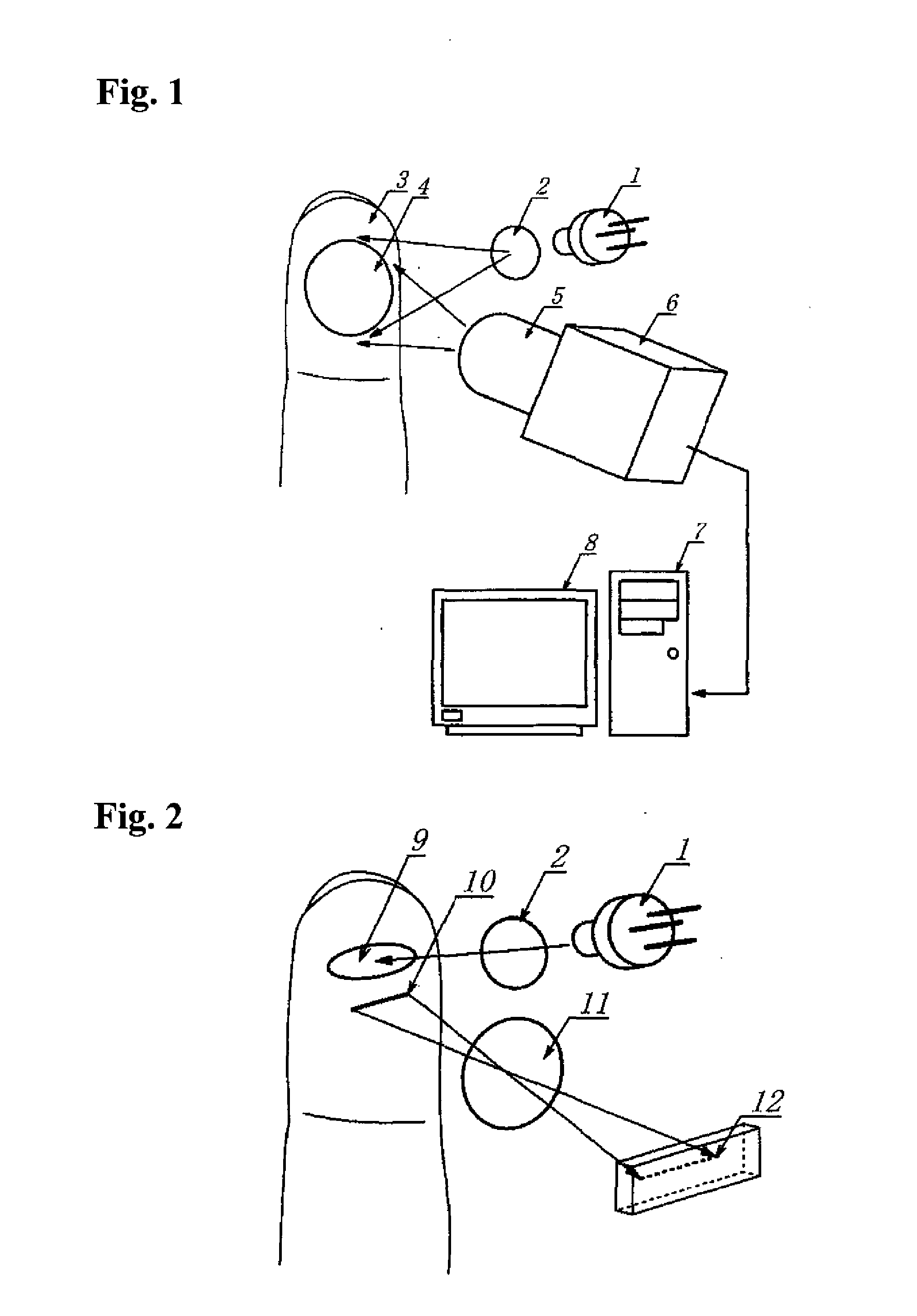 Personal authentication method using subcutaneous bloodstream measurement and personal authentication device