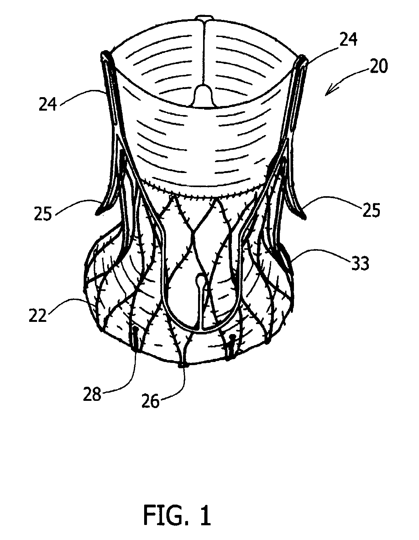 Stent loading tool and method for use thereof