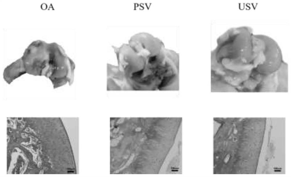 A preparation method and application method of ultrasound-targeted microbubbles carrying simvastatin