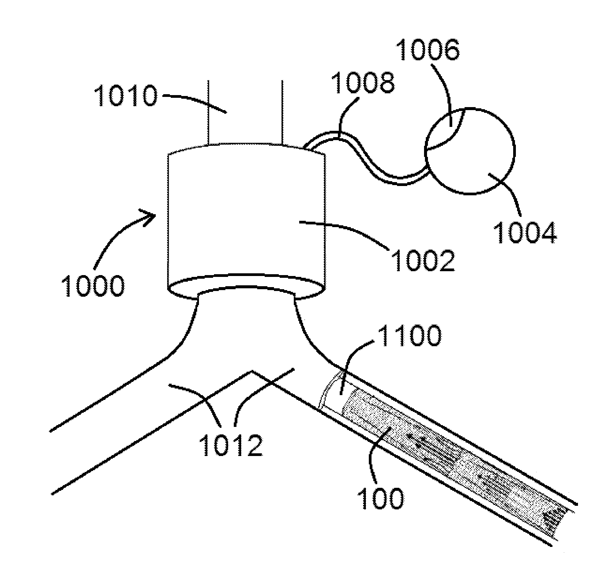 Devices and methods for assisting valve function, replacing venous valves, and predicting valve treatment success