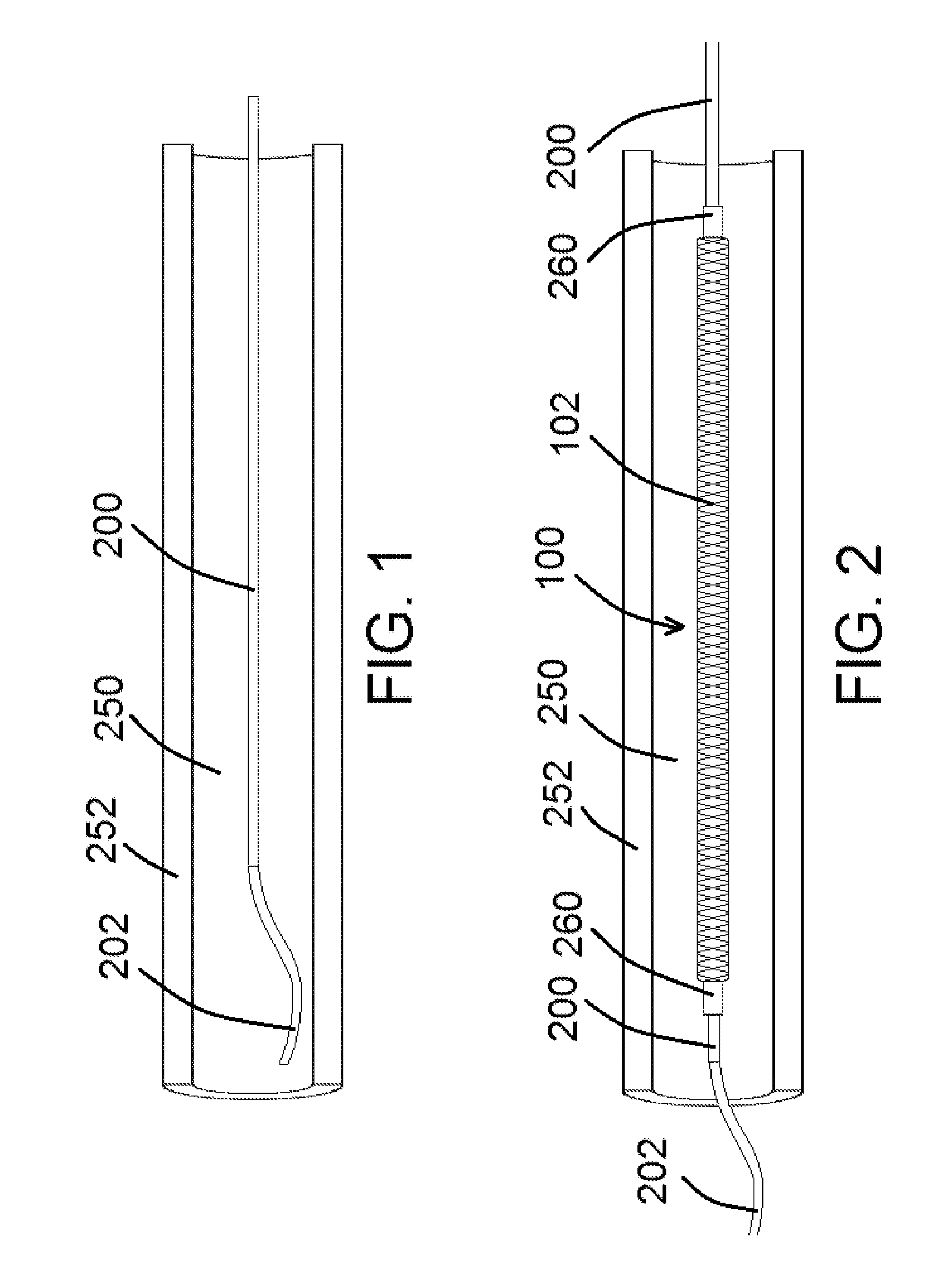Devices and methods for assisting valve function, replacing venous valves, and predicting valve treatment success