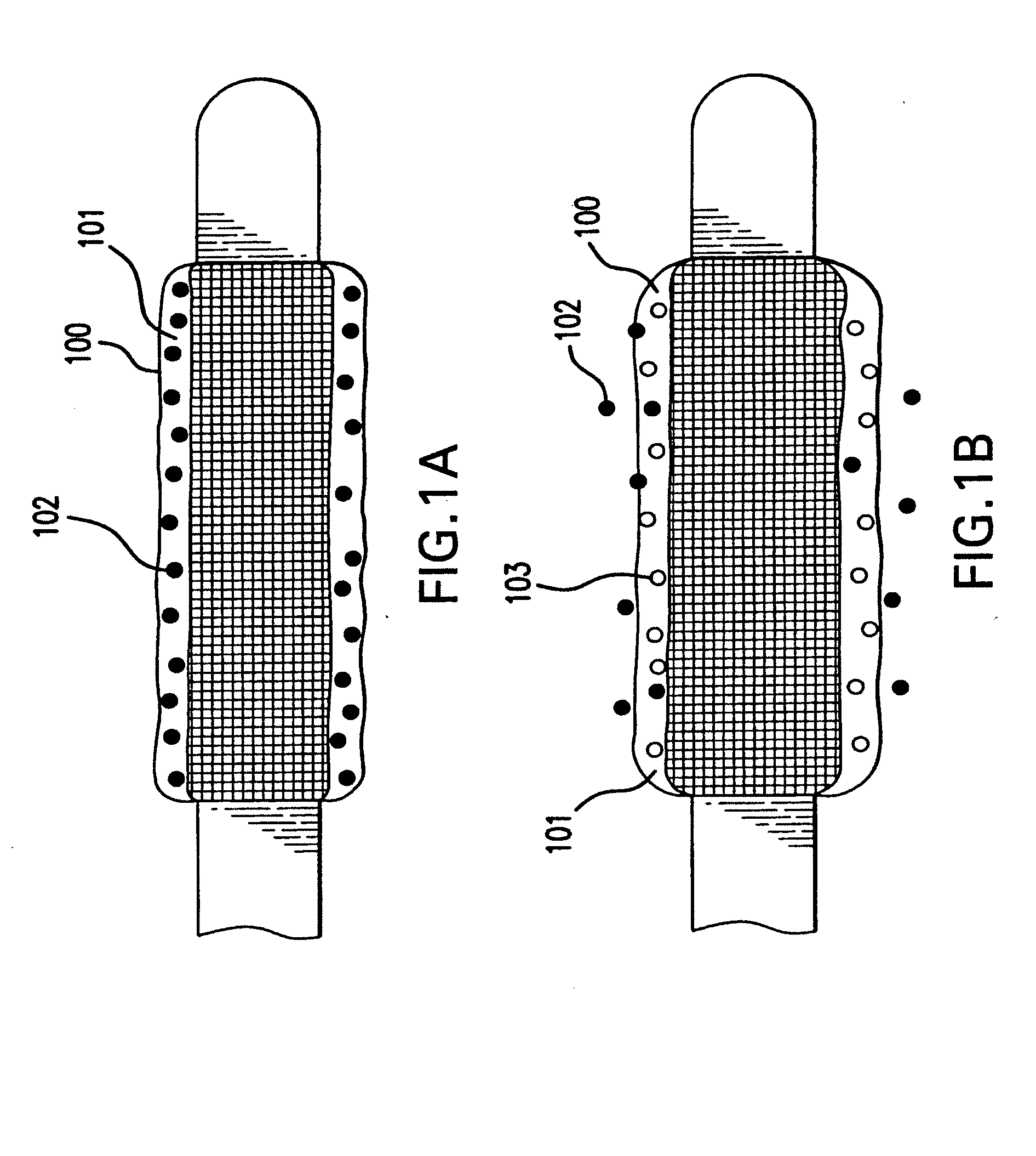 Medical device with porous surface for controlled drug release and method of making the same