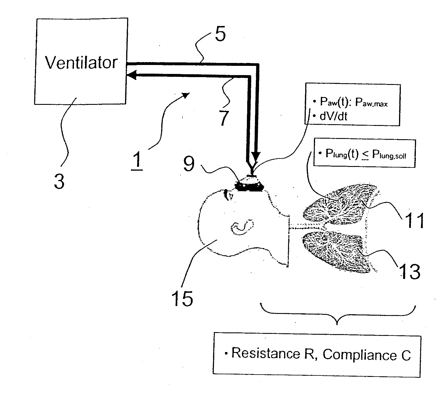 Device for supplying a patient with breathing gas and process for regulating a respirator