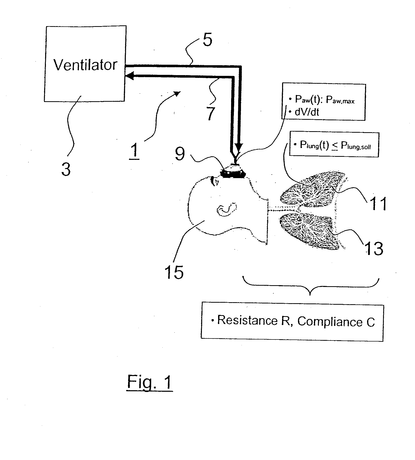 Device for supplying a patient with breathing gas and process for regulating a respirator