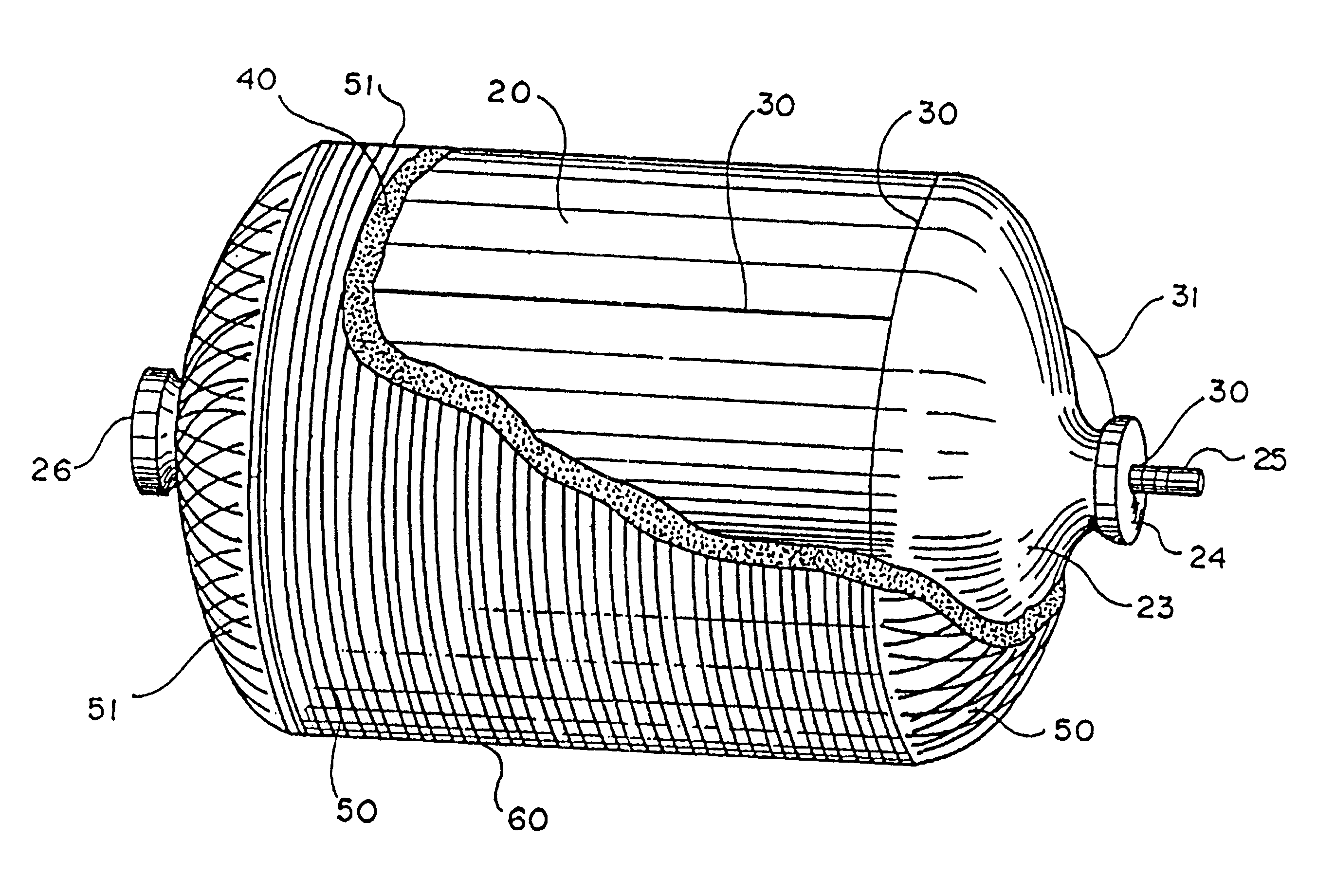 High performance, thin metal lined, composite overwrapped pressure vessel
