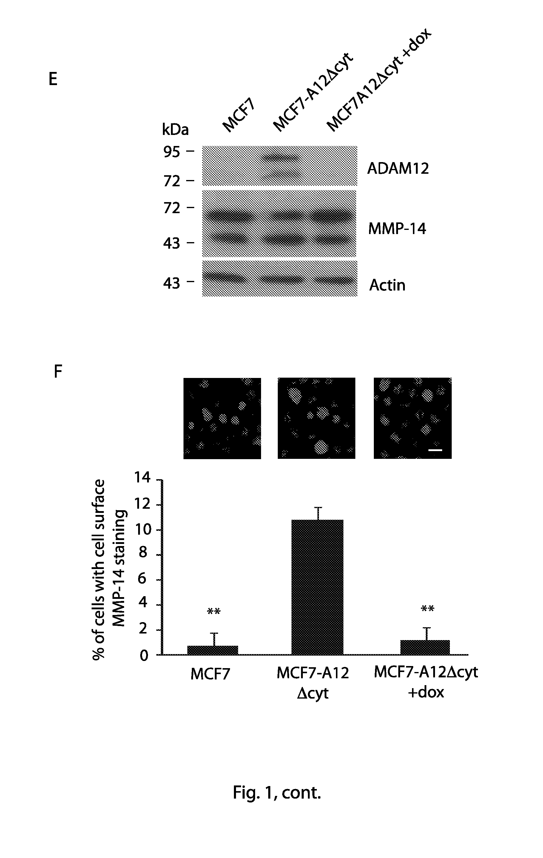 Anti-ADAM12 antibodies for the treatment of cancer