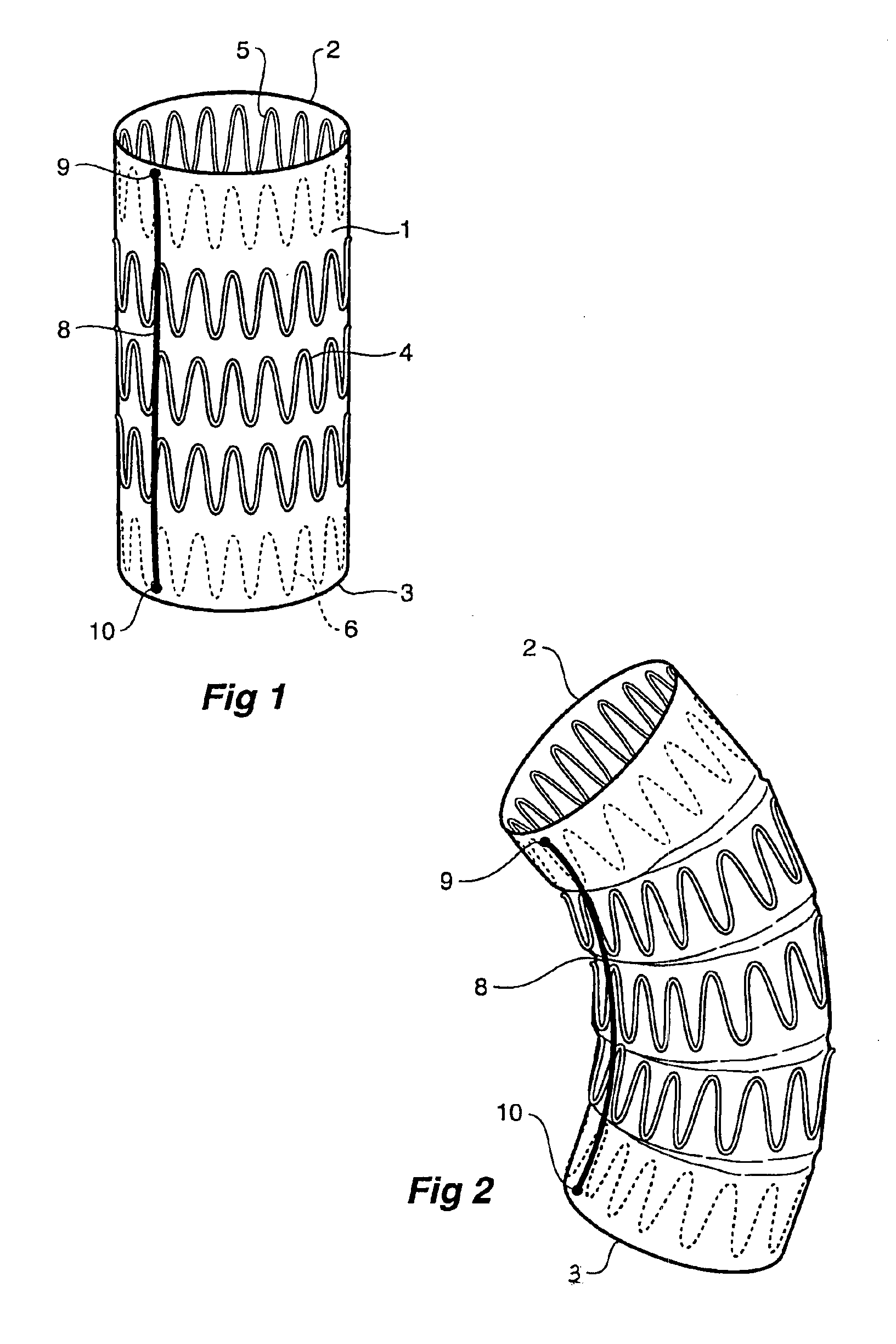 Prostheses for curved lumens