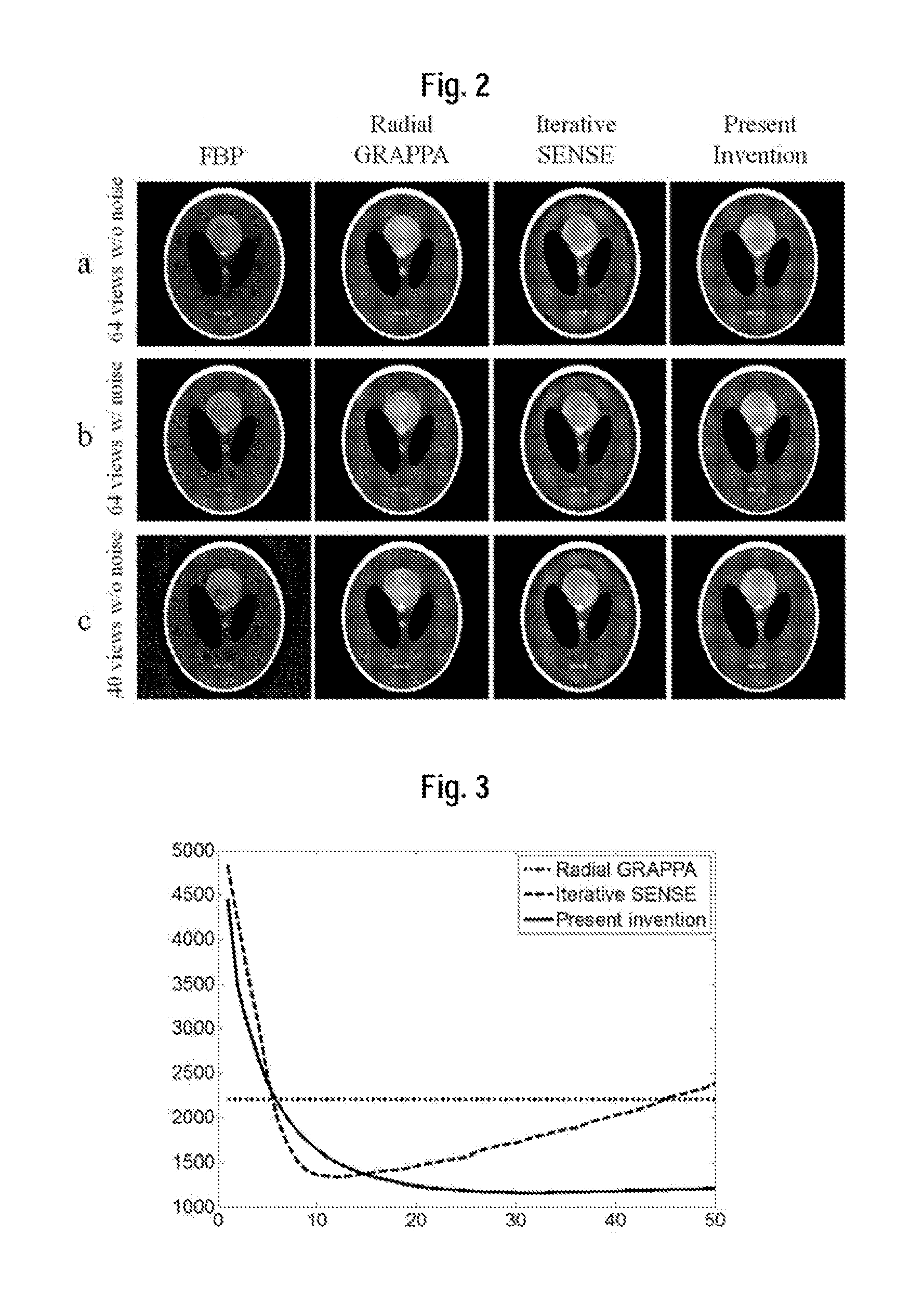 Parallel magnetic resonance imaging method for radial trajectory
