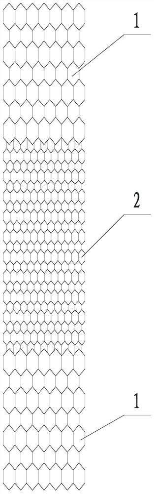 Balloon expansion type absorbable vein stent