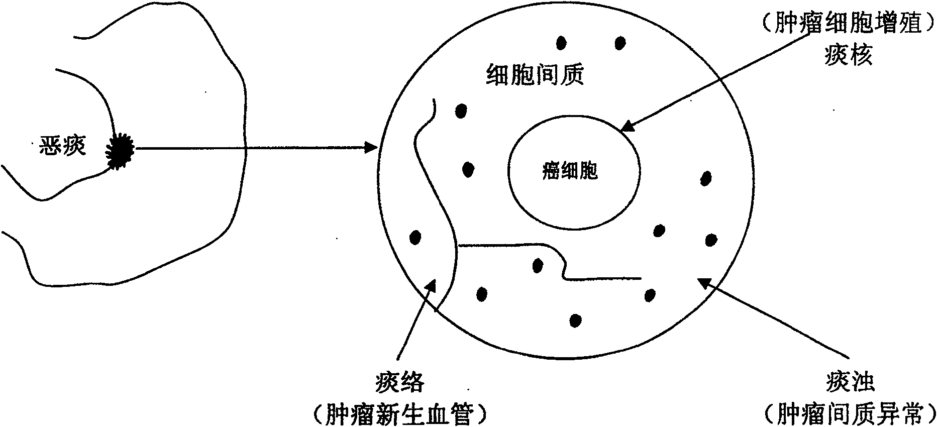 Anticancer Chinese medicinal composition and preparation method thereof