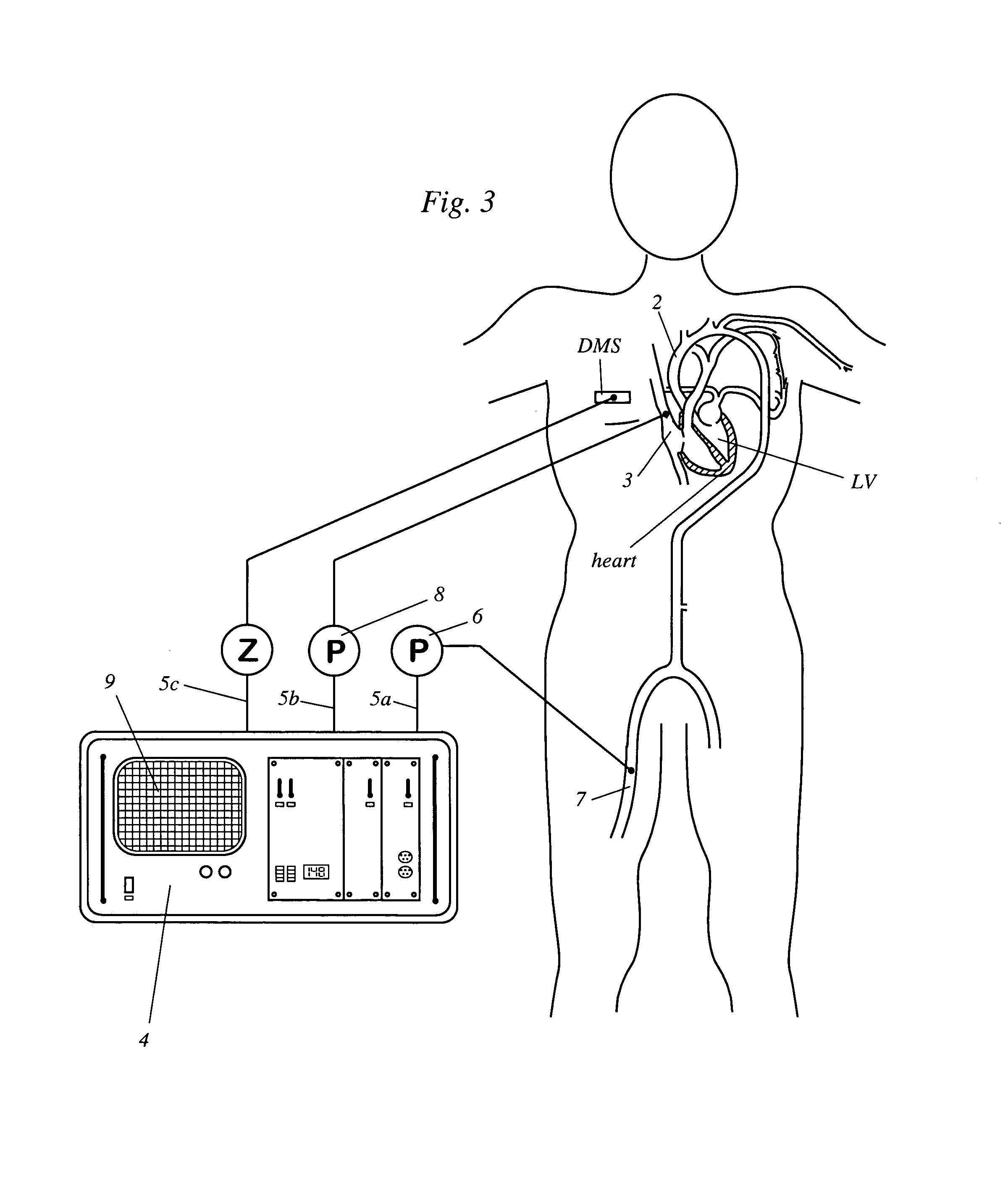 Apparatus for determining cardiovascular parameters