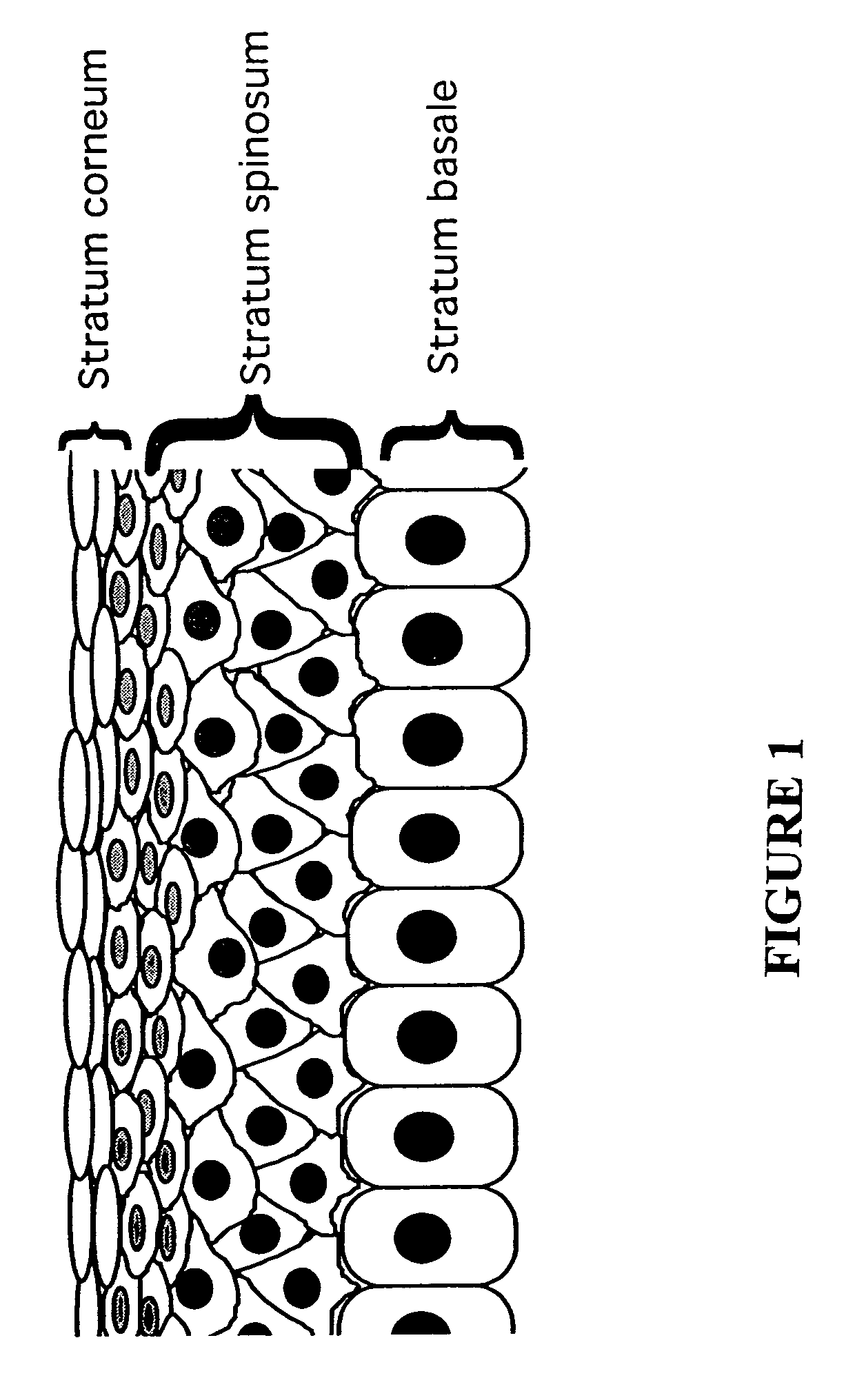 Compositions and methods for treating skin conditions