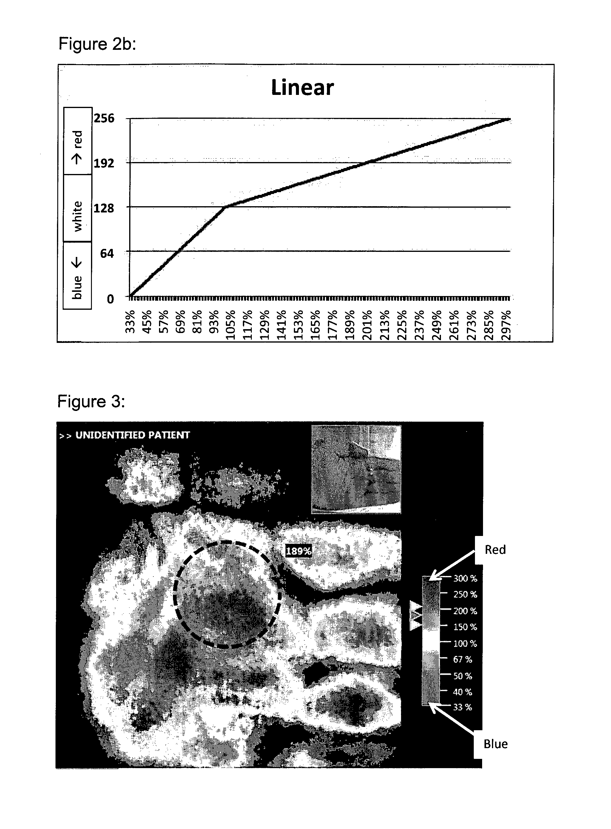 Optical coherent imaging medical device