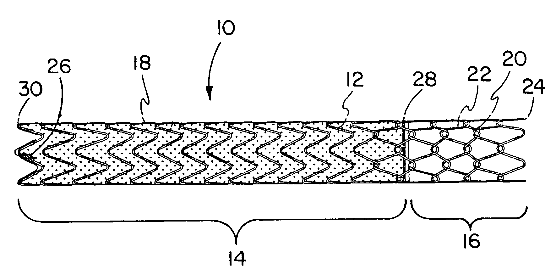 Covered endoprosthesis and delivery system