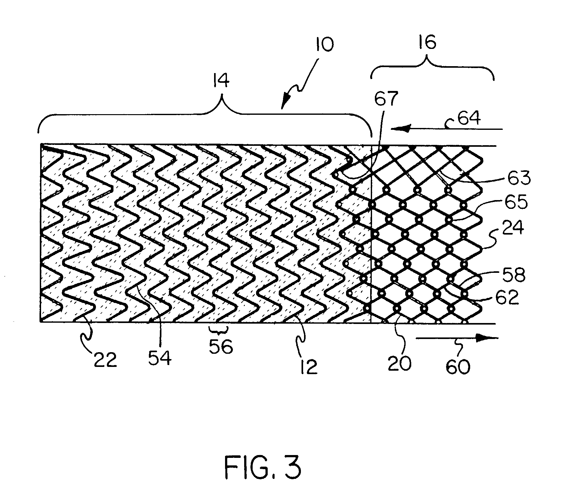 Covered endoprosthesis and delivery system