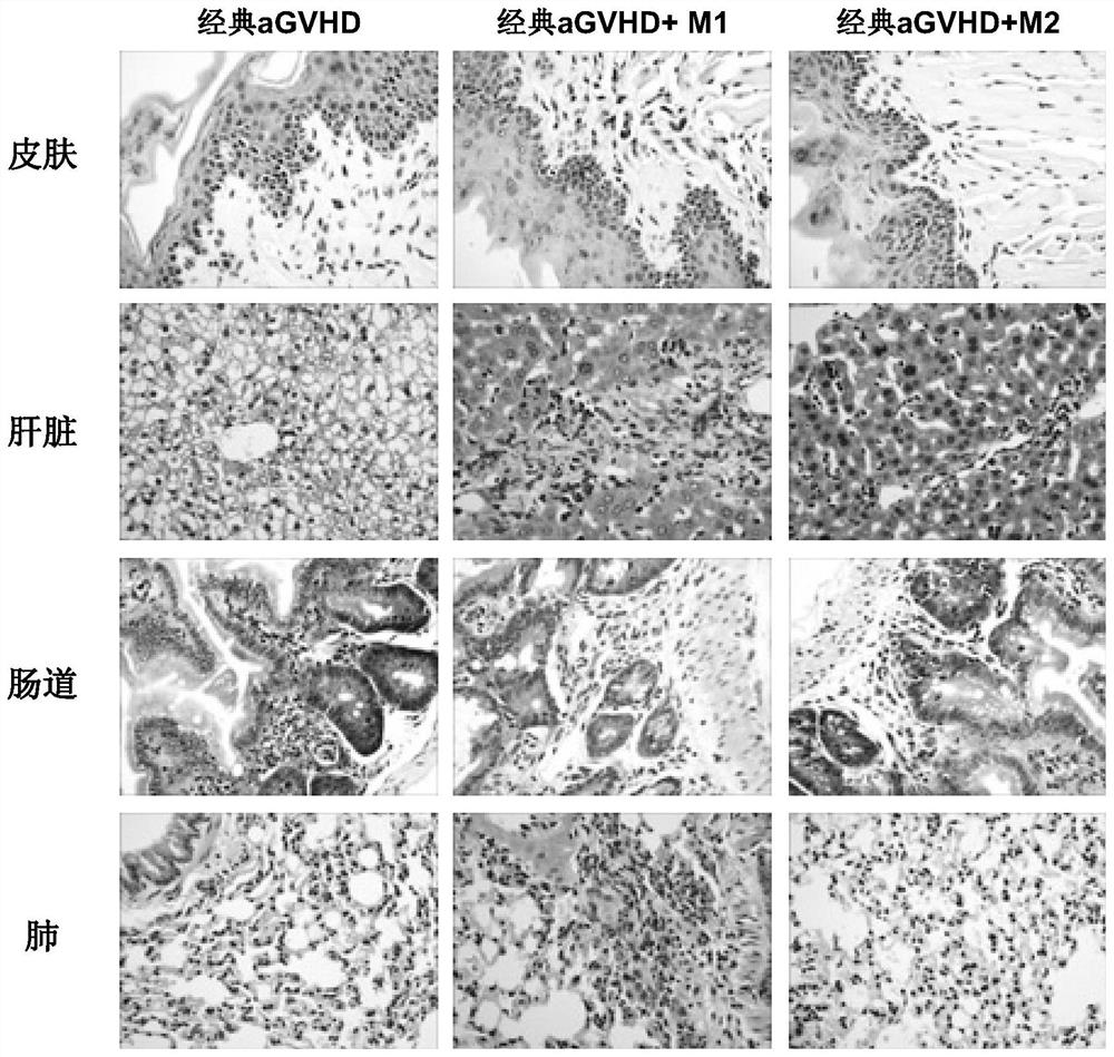 Application of macrophage subset and regulator thereof in acute graft versus host disease (aGVHD)