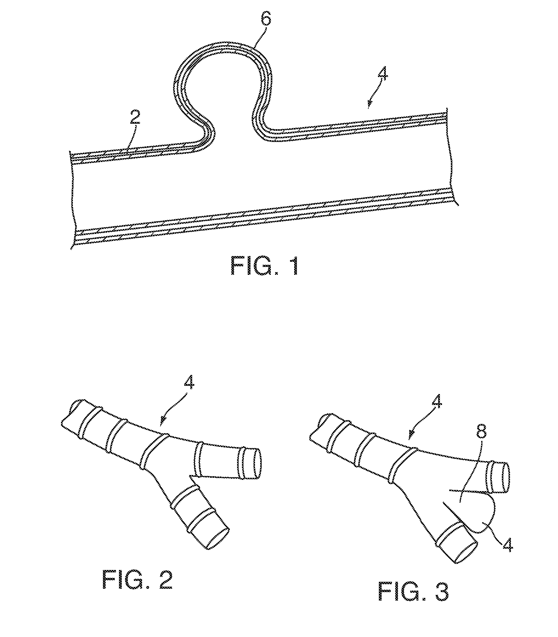 Vascular occlusion devices and methods