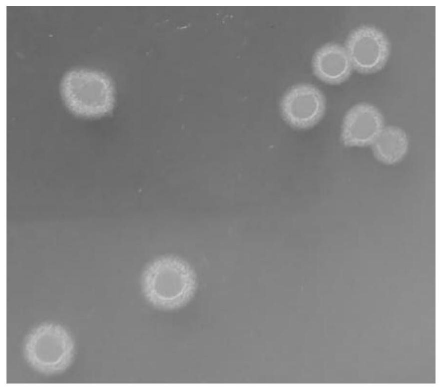 Insect-killing and disease-preventing compound microbial agent and biological fertilizer containing microbial agent