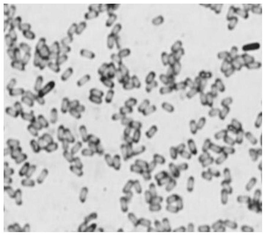 Insect-killing and disease-preventing compound microbial agent and biological fertilizer containing microbial agent